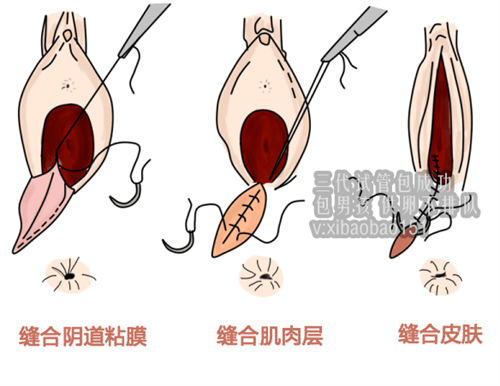 上海供卵哪里比较靠谱_保护卵巢有什么办法？